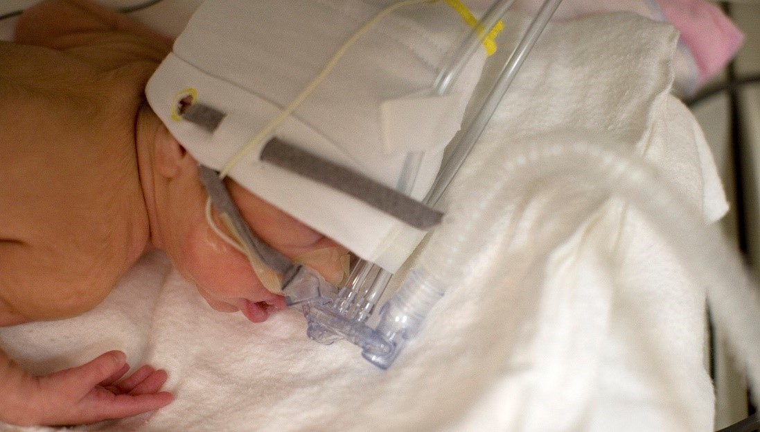 Non-Invasive Support In Neonatal Respiratory Distress | Clinical View